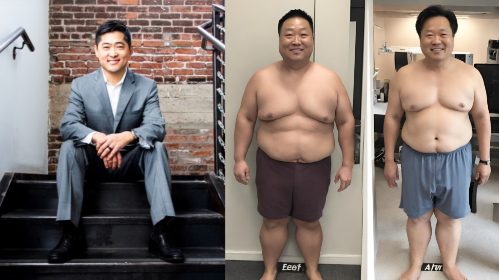 Dr Michael kim Weight Loss