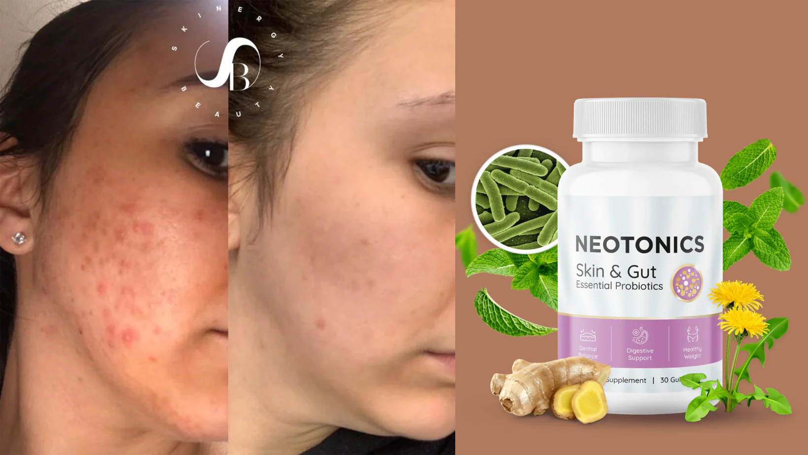 face dark spot remover neotonics