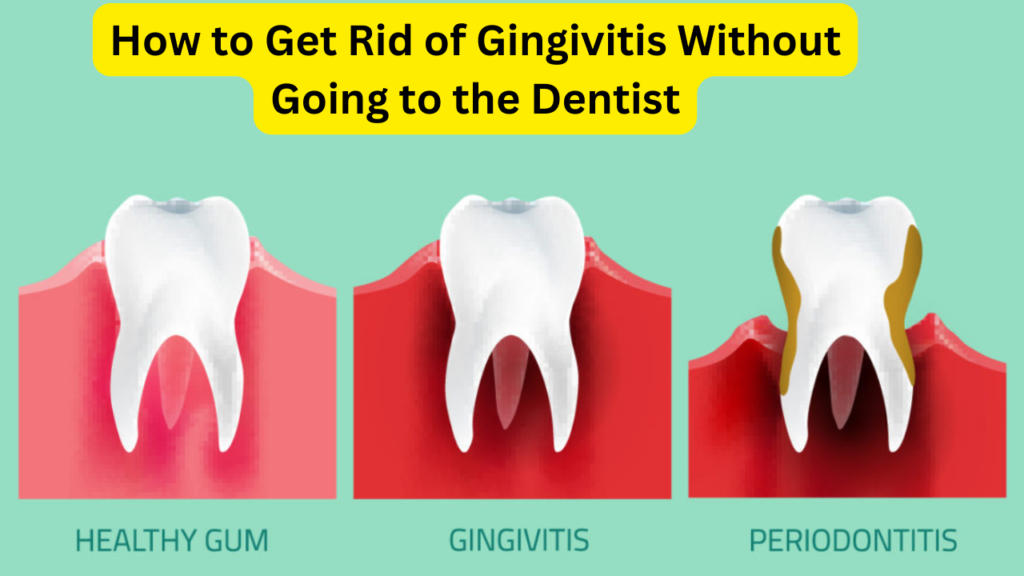 how-to-get-rid-of-gingivitis-without-going-to-the-dentist-time-for-relax