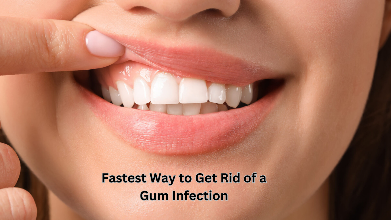 what-is-the-fastest-way-to-get-rid-of-a-gum-infection-time-for-relax