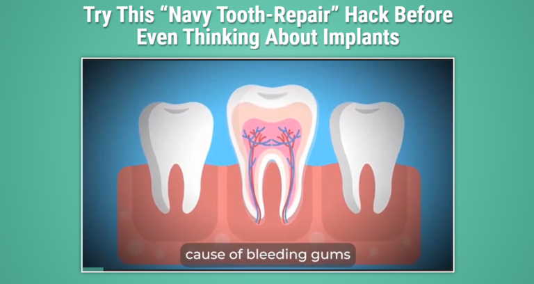 Navy Tooth Repair Hack