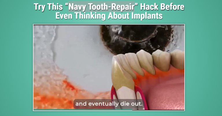 Navy Tooth Repair Hack Reviews